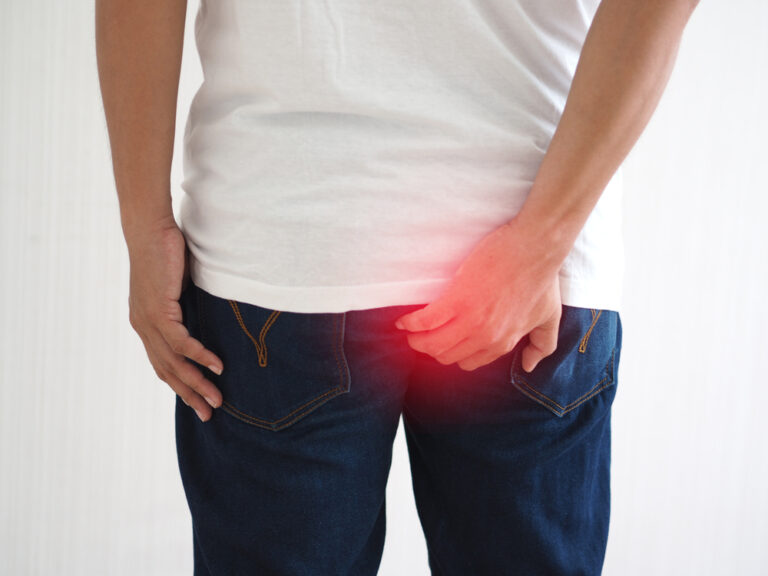 A man holds his bum through his jeans in pain due to haemorrhoids, the affected area is highlighted red