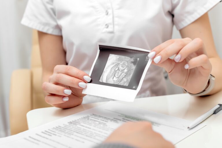 A doctor shows her patient an ultrasound image of her ovarian cyst.