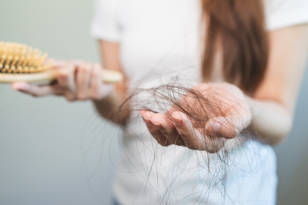 A woman holds a clump of hair in her hand due to her PCOS.